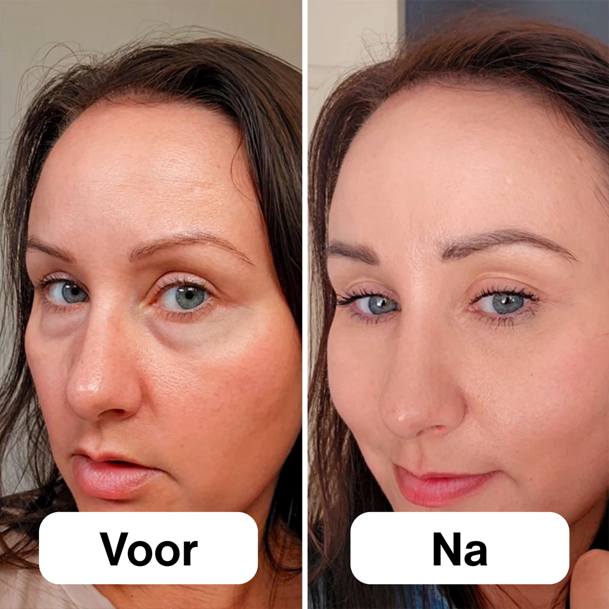 EyeSculpt™ Verstevigende Oogpods