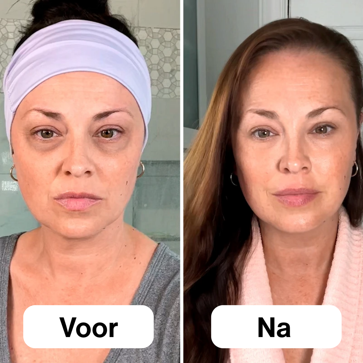 EyeSculpt™ Verstevigende Oogpods
