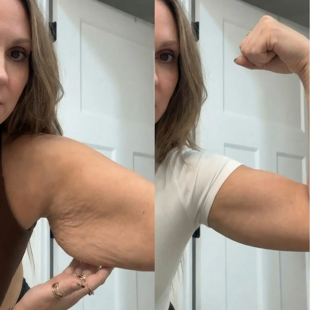 ContouraLift™ 3-in-1 Bodysculpter