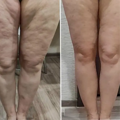 ContouraLift™ 3-in-1 Bodysculpter