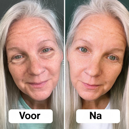 EyeSculpt™ Verstevigende Oogpods