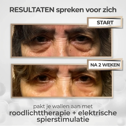 LumiLift™ Oogverzorgingsapparaat